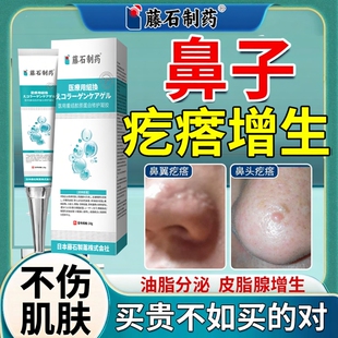 鼻子上小肉疙瘩鼻翼鼻头增生皮脂腺增生痘疤凸起酒糟鼻脸上肉粒OZ