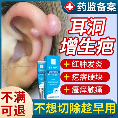 耳洞增生疤痕疙瘩软化修复祛疤膏