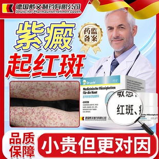 过敏性紫癜专用可搭 特色素性效紫癜性皮炎血管炎药房同款膏OZ