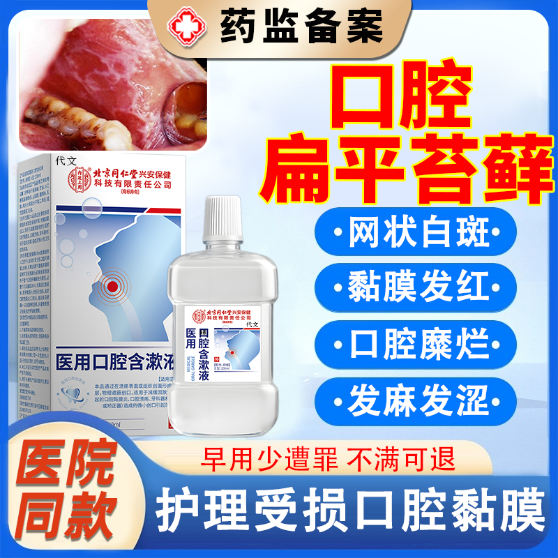 【口腔扁平苔藓】医用口腔含漱液