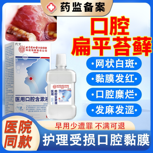 【口腔扁平苔藓】医用口腔含漱液