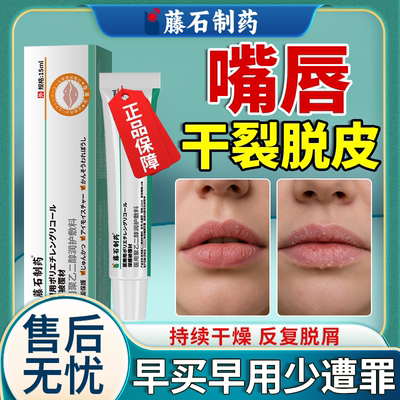【随身常备】嘴唇干皮脱屑润唇膏