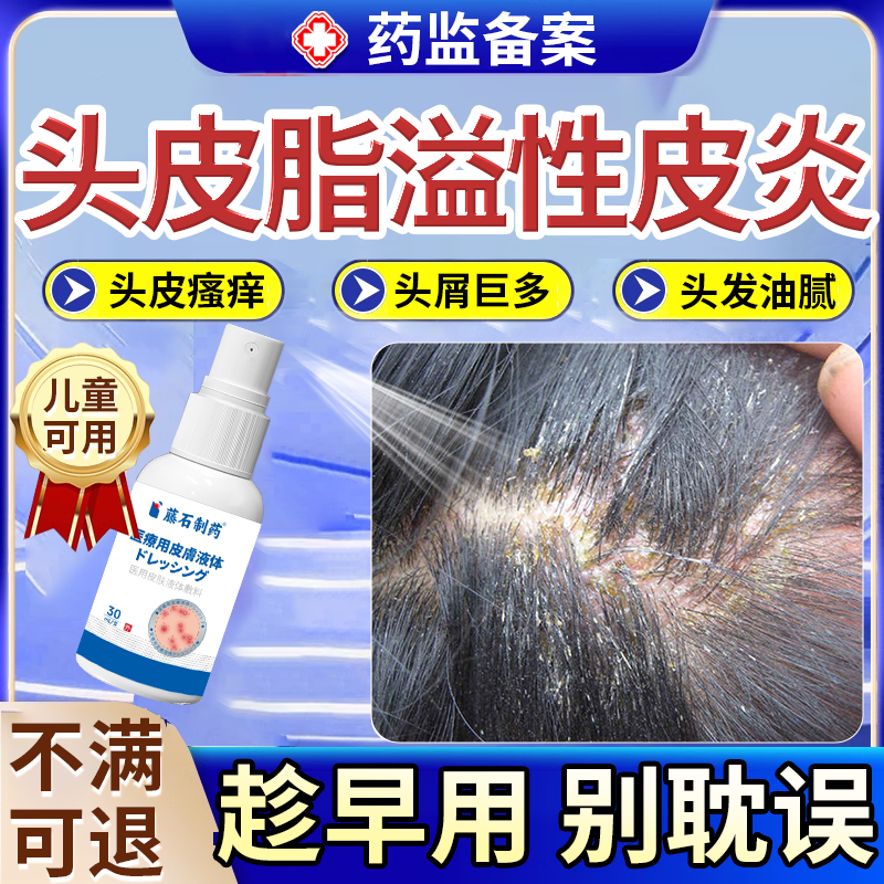 儿童头皮屑脂溢性皮炎去真菌感染头癣毛囊炎专用洗发水头部喷剂JW