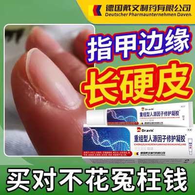 软化手指硬皮指甲两侧硬茧边缘去死皮神器膏手部老茧角质软化剂YR