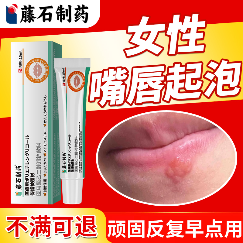 【女性嘴唇起泡疼反复】现货速发