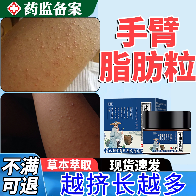 手臂脂肪粒去除神器可搭膏药贴胳膊上的小疙瘩毛囊炎鸡皮肤专用jw