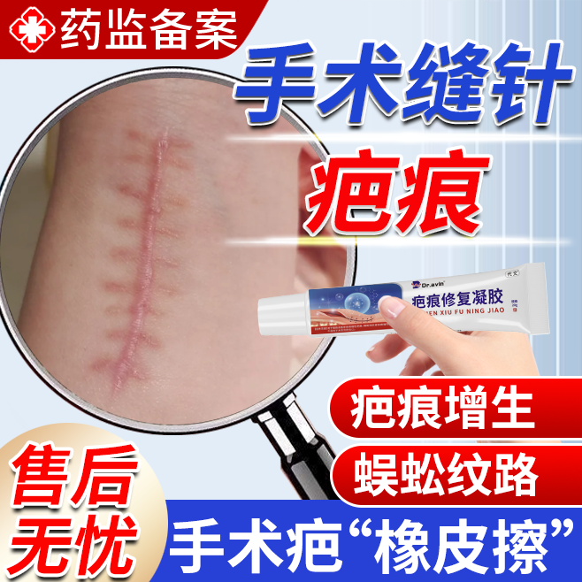手术缝针疤痕修复除疤膏手术伤口刀口祛疤贴痘疤增生去除祛疤膏EM