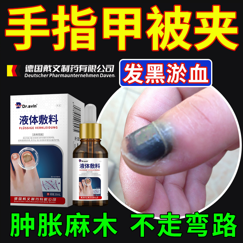 手指甲被夹发黑】就用它