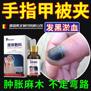 手指甲被砸压夹受伤淤血大拇指坏死脚趾甲下修出血复液受损再生OZ