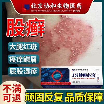 大腿内侧真菌股癣止痒药膏