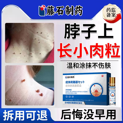 【医用级】脖子上长小肉粒疙瘩