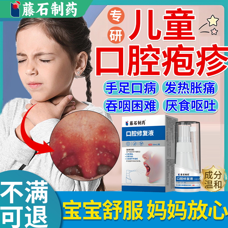 手足口病药房同款重组人工干扰素a2b气喷雾剂人体口腔疱疹儿童BS