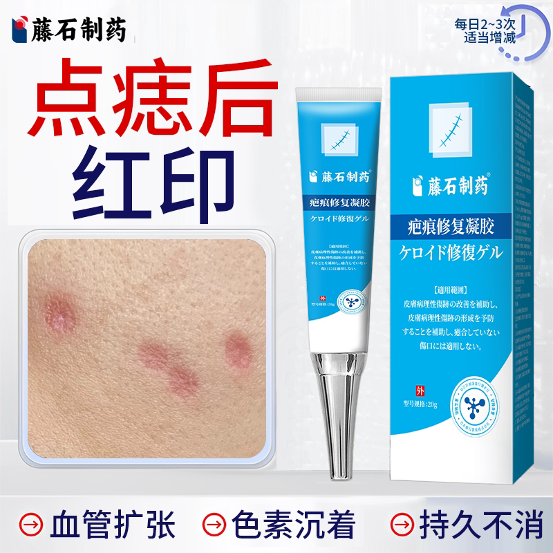 点斑点痣后去红印修复膏图片