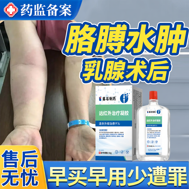 乳腺术后上肢淋巴水肿压力袖套绷带手套康复用品药房同款医用JW