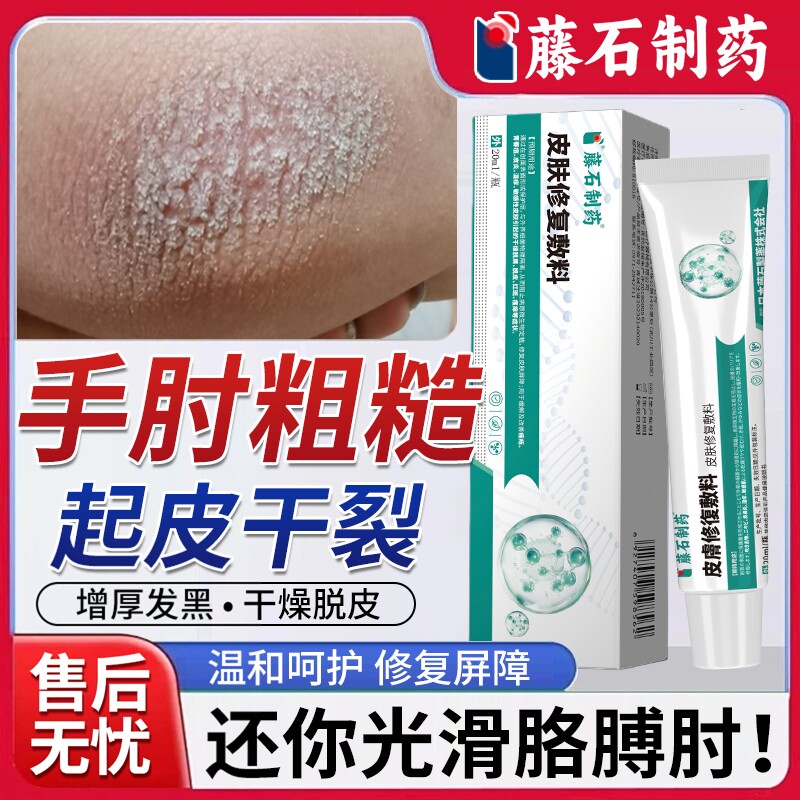 手肘干燥起皮开裂癣皮炎膏胳膊肘去黑去死皮神器黑色素沉淀去除BS