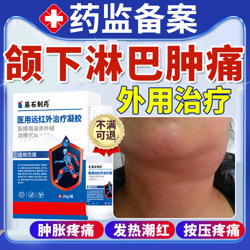 颌下淋巴结炎肿大散结消散贴膏消脖子颈部除结节腋下炎药房同款OZ