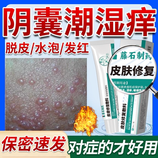 男人阴囊湿疹膏睾丸潮湿瘙痒搭专用止痒去特根效脱皮药房同款膏OZ