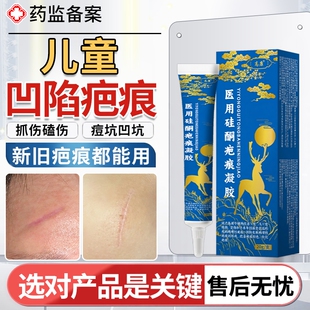 凹陷性疤痕儿童小孩脸部摔伤指甲抓伤专用除修复祛疤去疤除疤膏JW