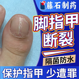 脚趾指甲盖断裂医用保护贴罩受伤裂开劈裂修复灰指甲防水护甲套DZ