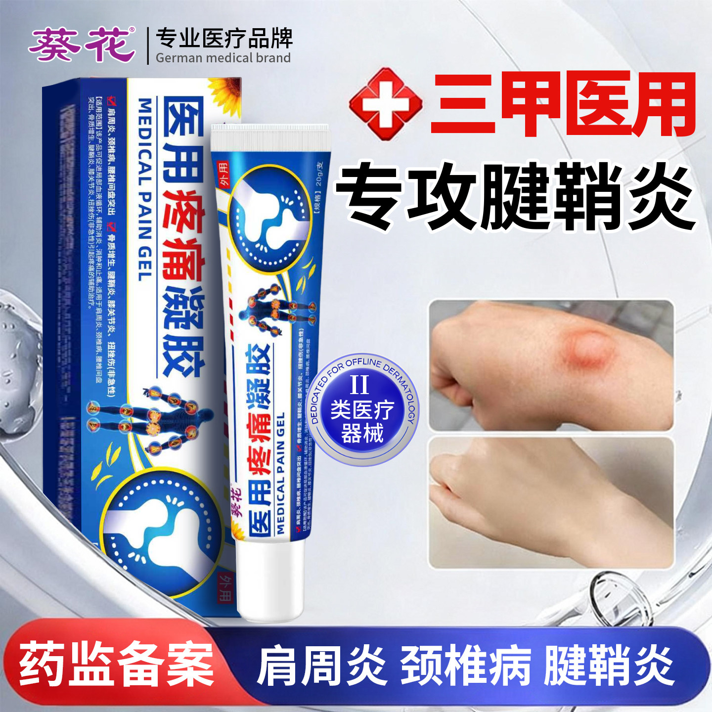 葵花医用疼痛凝胶手指肿胀变形消炎止痛腱鞘炎按摩膏关节远红外