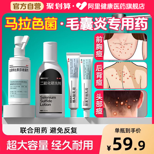 马拉色菌药毛囊炎前胸去后背胸口祛痘背部上长痘痘真菌性专用喷雾