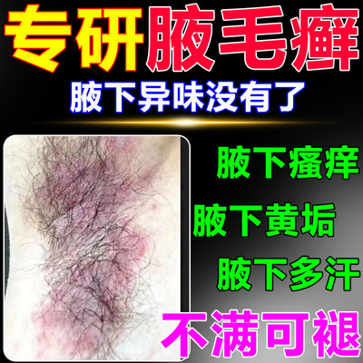 【腋毛藓消除喷雾剂】专用神器