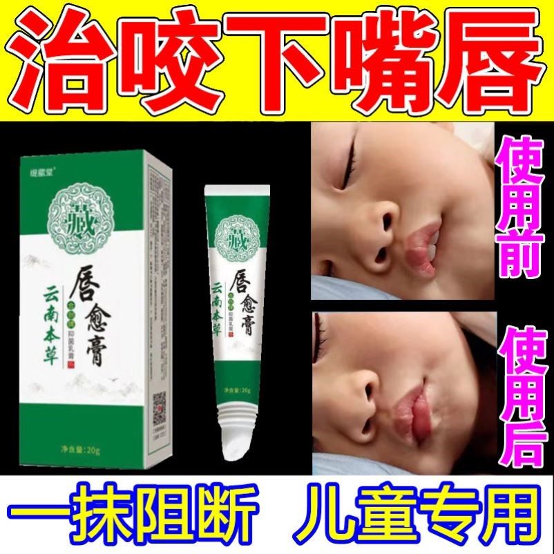 宝宝防咬下嘴唇纠正器神器改善小孩子口呼吸戒咬嘴唇矫正前庭盾贴