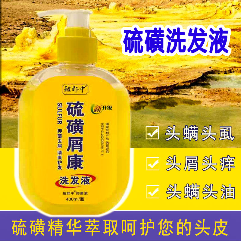 洗发水控油硫磺头皮屑祖郎中