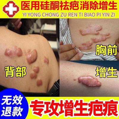祛疤膏痕增生凸起去除疙瘩