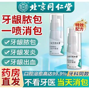 儿童牙龈脓包牙根发炎肿包肿痛消炎药牙周炎智齿牙疼消炎上火喷雾