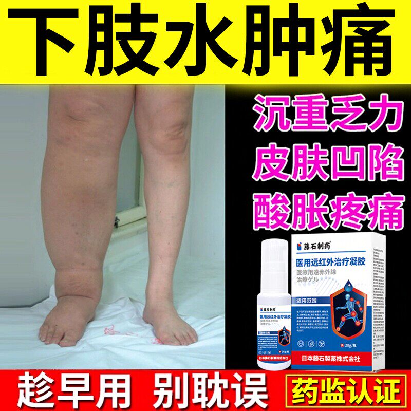 下肢术后淋巴水肿可搭配小腿浮肿袜压力弹力带绷带医用YZ