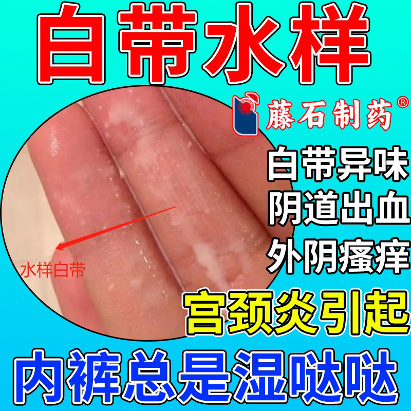 白带水样发黄增多宫颈炎腥臭外阴瘙痒阴道异常出血凝胶药监备案PG