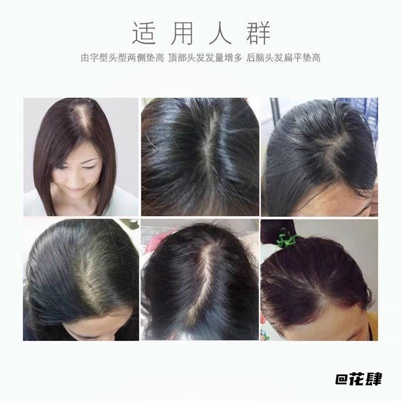 头饰假发短发隐形增高发根自然刘海发垫盘发插发梳头顶女生蓬松