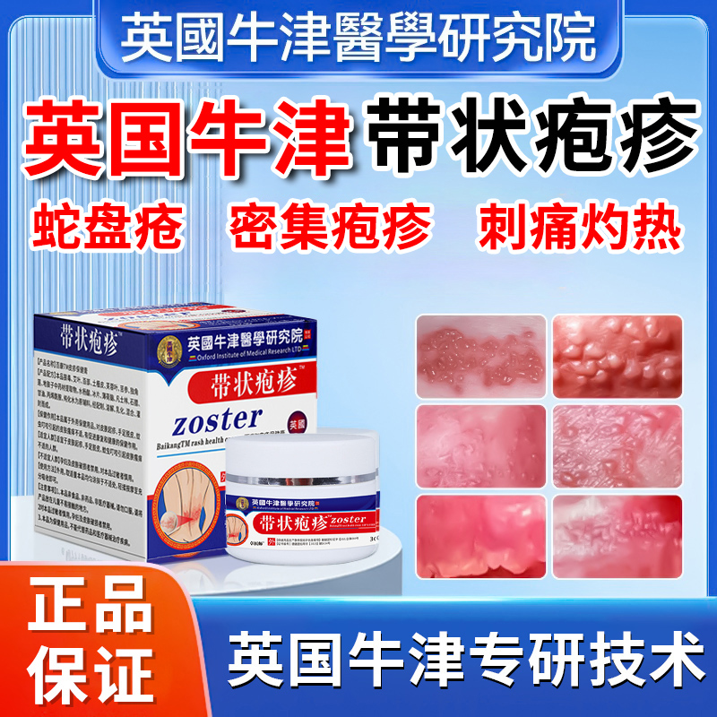 英国牛津医学研究院带状疱疹