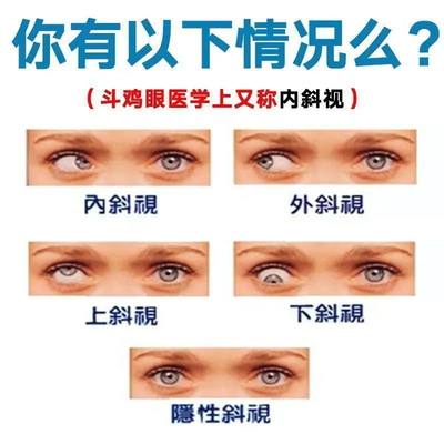 三天纠正】斜视矫正器训练器改善内斜外斜斗鸡眼斜眼弱视纠正眼镜