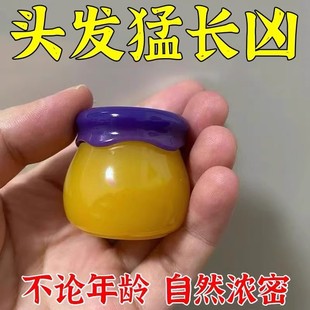 生发液增发密发头发际线快速增长液男女生防脱养发激活毛囊精华水