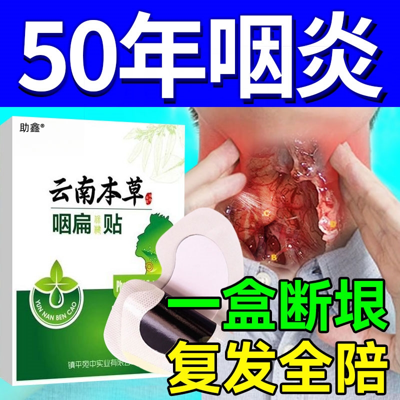 咽喉炎慢性咽炎贴除根止咳专用膏咽扁舒咳嗽化痰成人神器有异物感