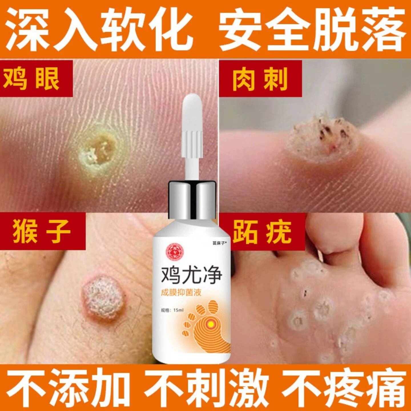 鸡尤净鸡眼药水肉刺扁平疣去除药膏一抹灵去鸡眼膏贴跖疣根用专膏
