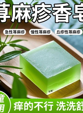 过敏性慢性胆碱性寻荨麻疹过敏止痒根提高免疫力止痒膏硫磺手工皂