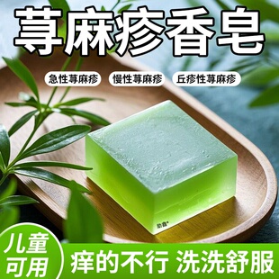 过敏性慢性胆碱性寻荨麻疹过敏止痒根提高免疫力止痒膏硫磺手工皂