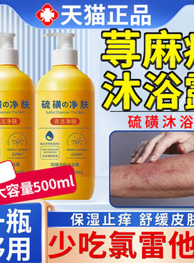 过敏性慢性胆碱性寻荨麻疹过敏止痒根提高免疫力止痒膏硫磺沐浴露