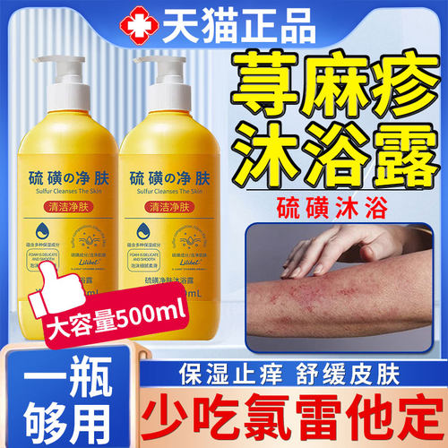过敏性慢性胆碱性寻荨麻疹过敏止痒根提高免疫力止痒膏硫磺沐浴露
