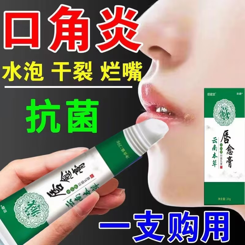 口角炎嘴角疱疹干裂脱皮唇炎膏