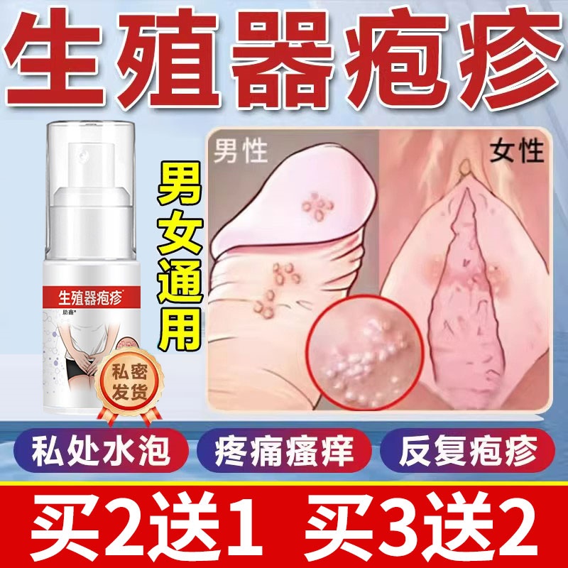 生殖器疱疹断疱疹根克星治喷雾真菌感染男女防复发中药膏瘙痒私处
