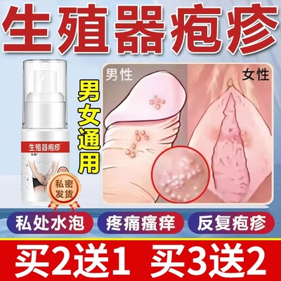 生殖器疱疹断疱疹根克星治喷雾真菌感染男女防复发中药膏瘙痒私处