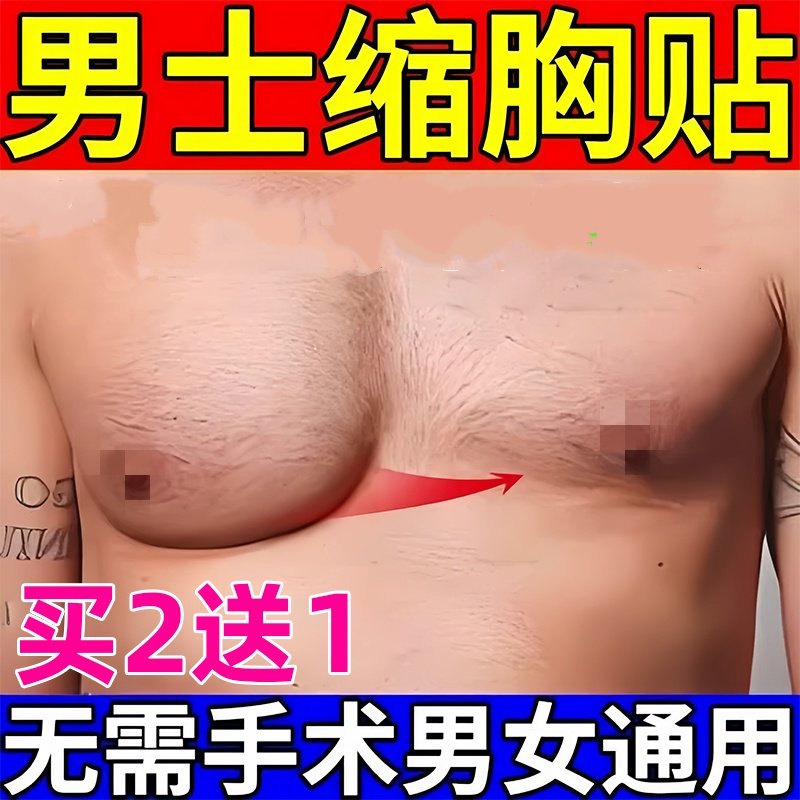 男性乳腺发育症增生乳房肥大胀痛除乳头雌化贴瘦胸缩胸结