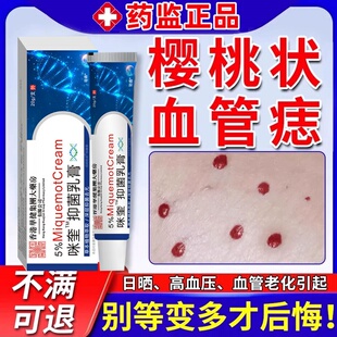 血管瘤血管痣去除樱桃状血管瘤点红痣蜘蛛痣去身上红痣黑疙瘩药膏