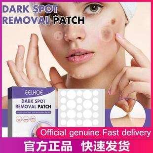 black spots patch melasma melanin Diminish Freckle