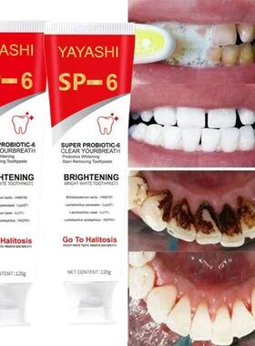 120g Probiotic Toothpaste SP-6 Whitening Tooth Remove