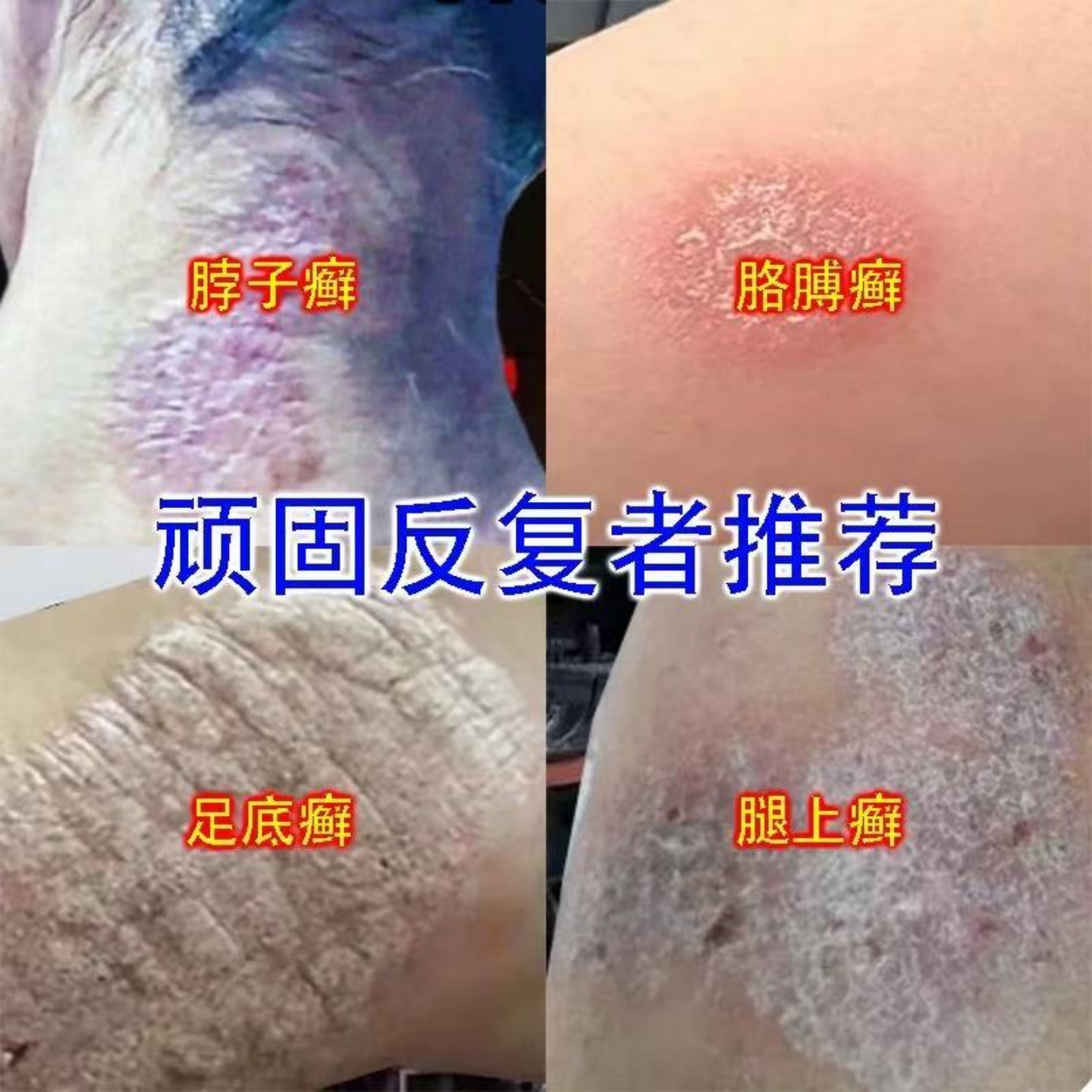 香港大药房【牛藓王救星】